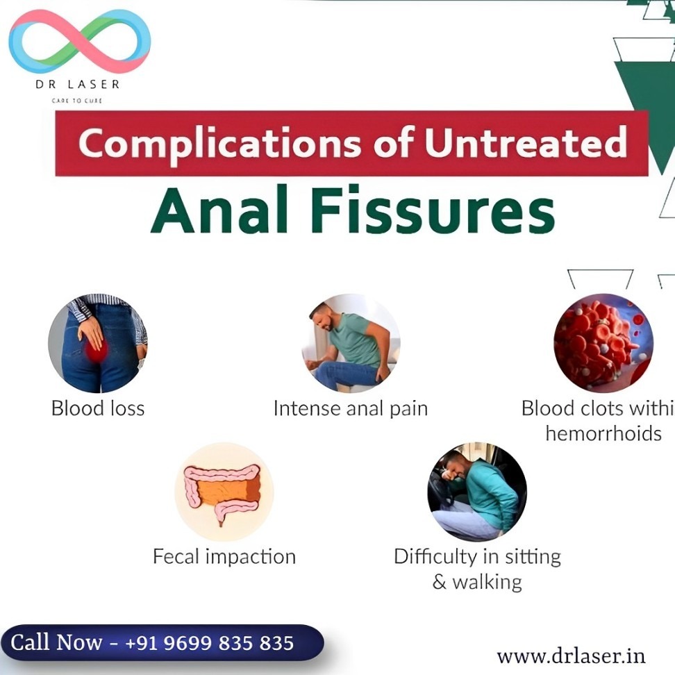 Welcome to DR LASER, where we specialize in the comprehensive care and treatment of anal fissures. Our mission is to provide effective solutions for individuals suffering from the complications of untreated anal fissures.