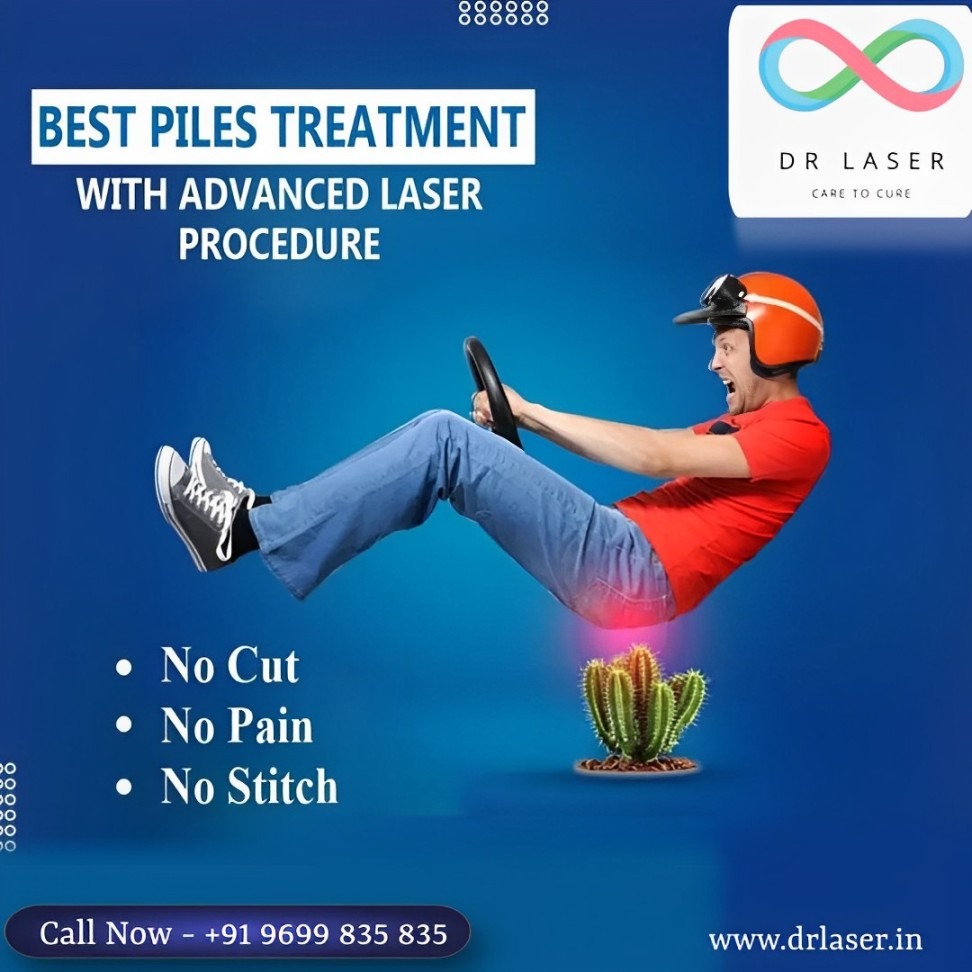 Advanced Laser Piles Treatment - No Cut, No Pain, No Stitch