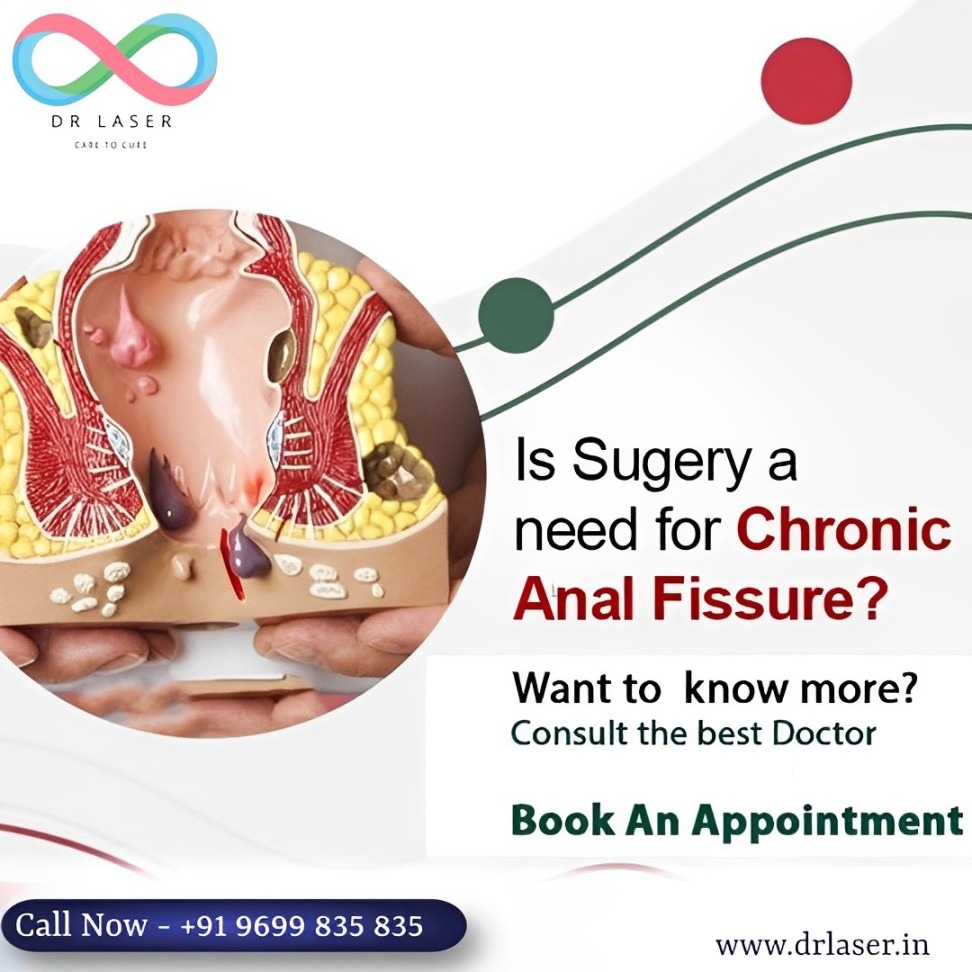At Piles Freedom Clinic, we understand the concerns surrounding chronic anal fissures and the necessity of surgery.