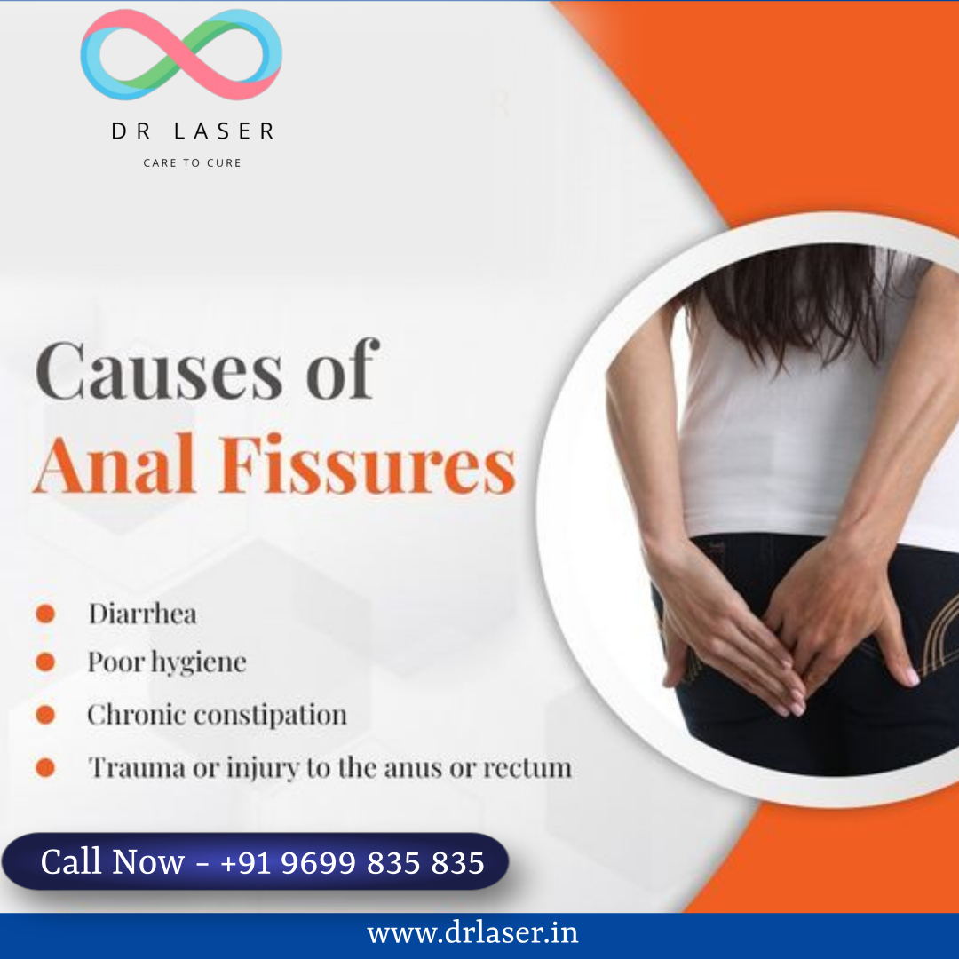 Discover the root causes of Anal Fissures with Dr. Laser Care. From diarrhea to trauma, unravel the factors behind this discomfort. #AnalFissures #DrLaserCare