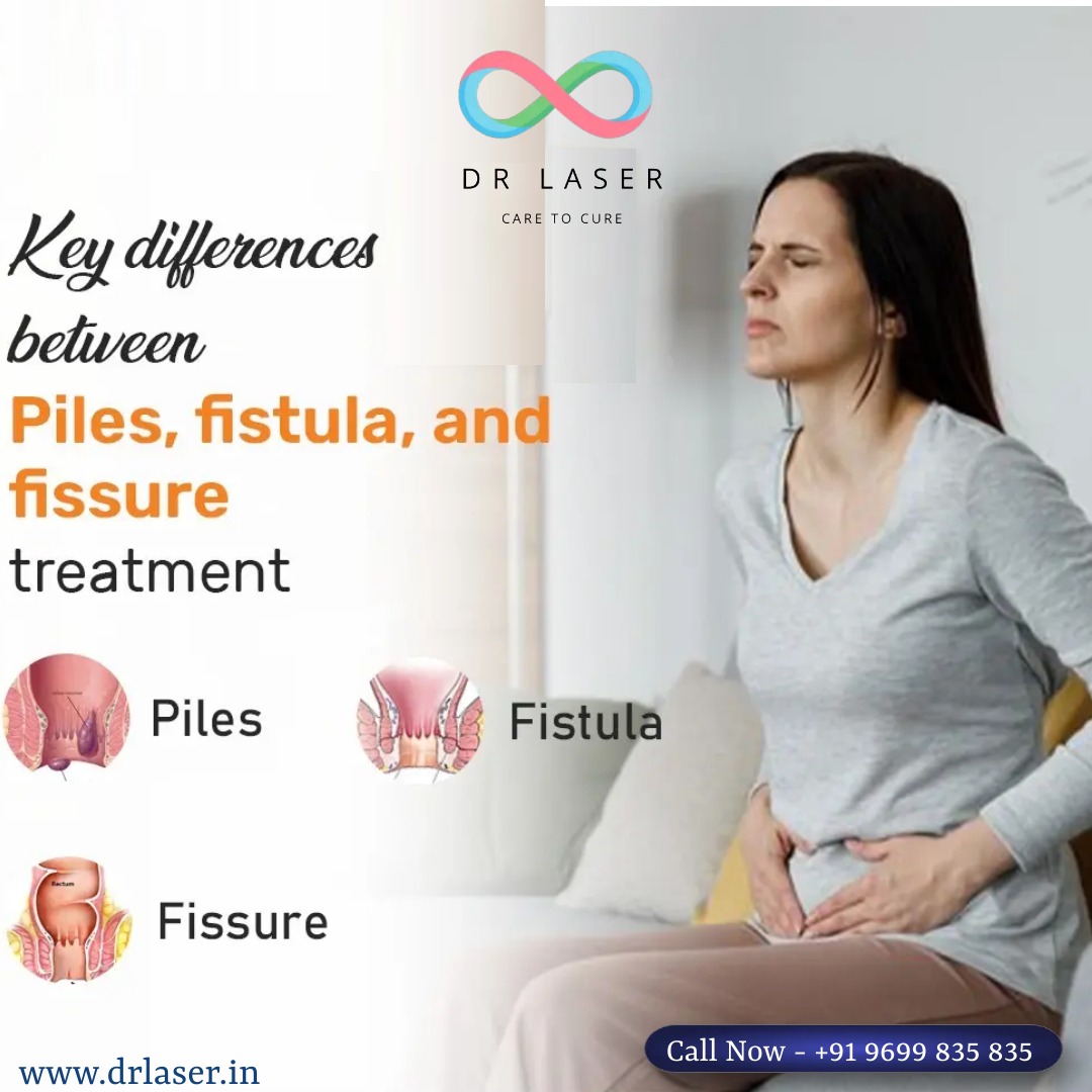 Comprehensive Treatment Solutions for Piles, Fistula, and Fissure
