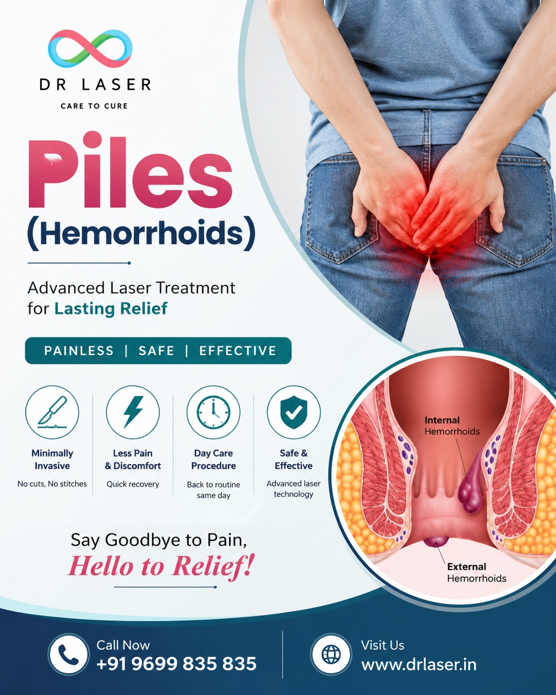 Piles (Hemorrhoids) causing pain and discomfort?
