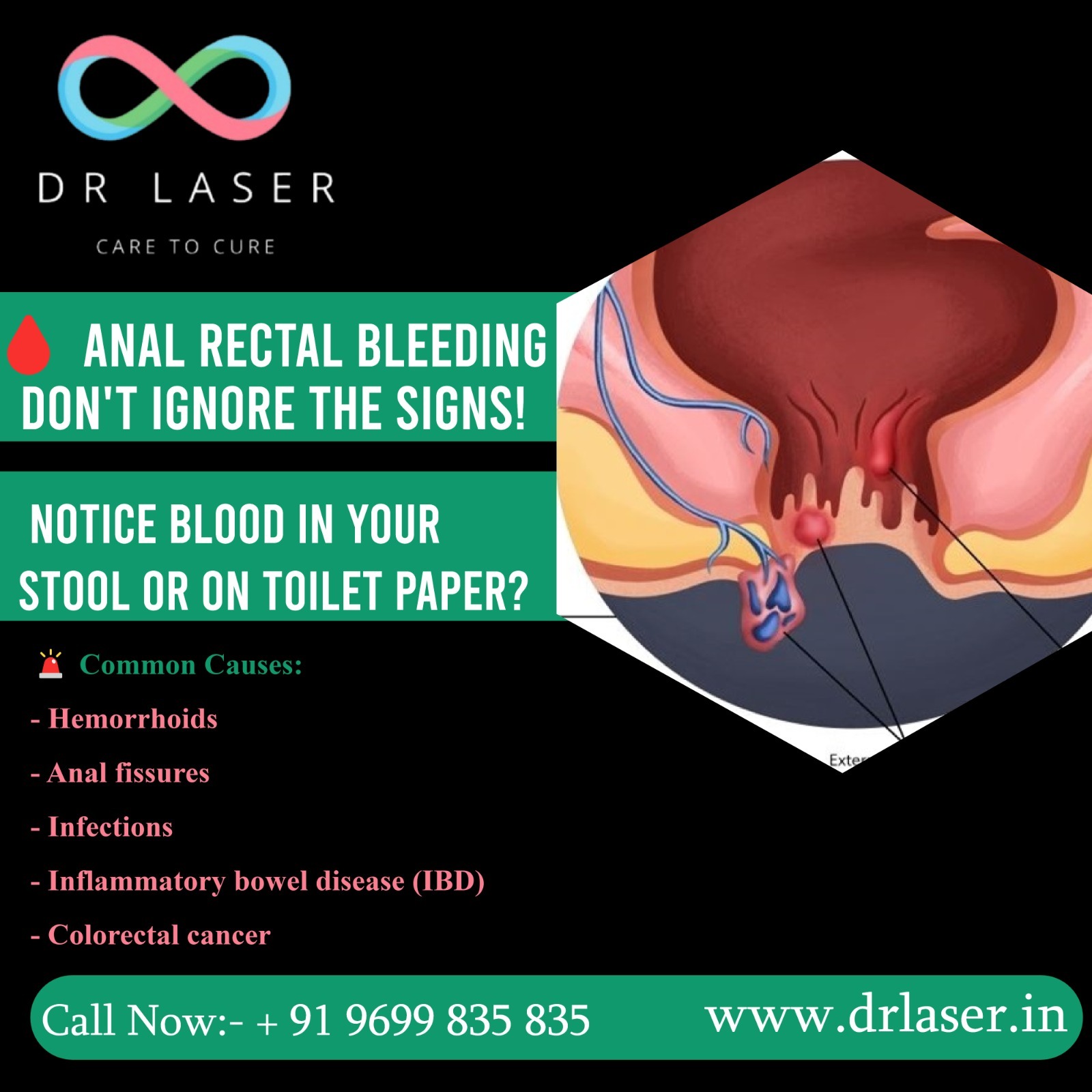 Anal Rectal Bleeding? Don't Ignore the Signs!