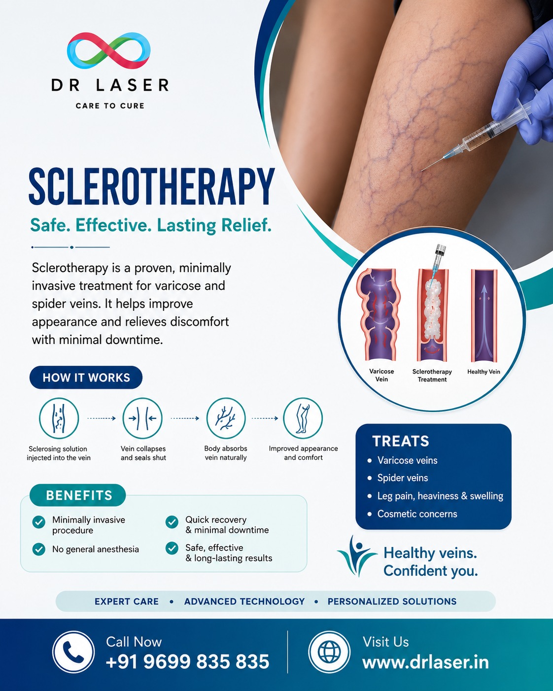 💙 Say Goodbye to Varicose & Spider Veins with Advanced Sclerotherapy!